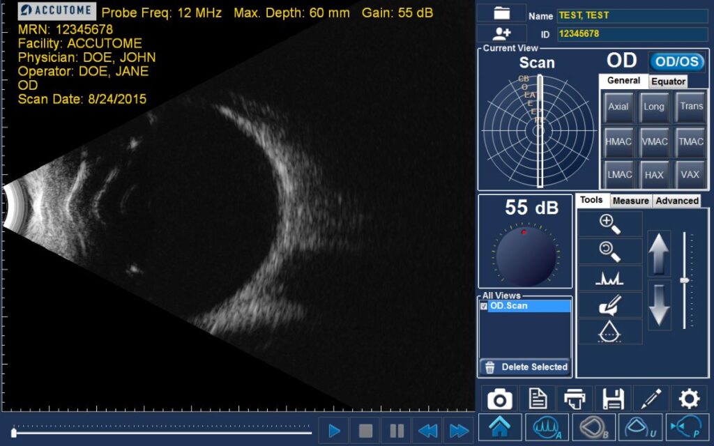 Accutome B-Scan Plus - Gold Coast Ophthalmic Instruments, Inc.