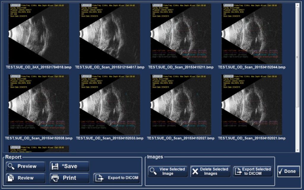 Accutome B-Scan Plus - Gold Coast Ophthalmic Instruments, Inc.