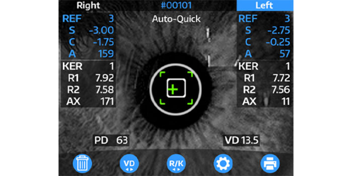 OptoChek® Plus Auto Refractor + Keratometer - Image 3